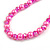 8mm/Glass Bead and Faux Pearl Necklace/Flex Bracelet/Drop Earrings Set in Pink Colours - 43cmL/4cm Ext - view 8